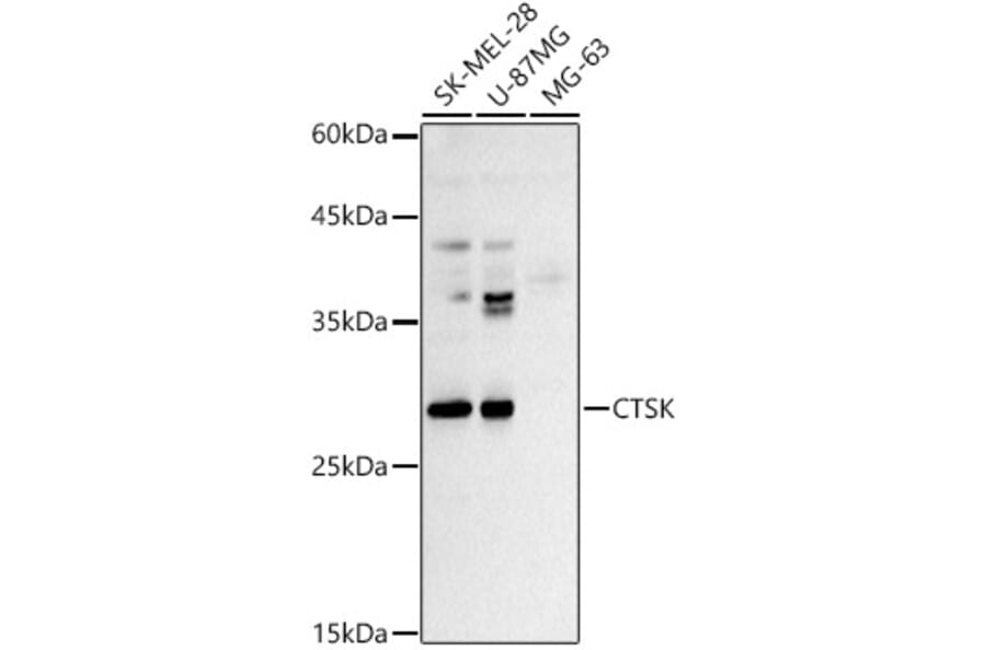 Western Blot - Anti-Cathepsin K Antibody (A13651) - Antibodies.com