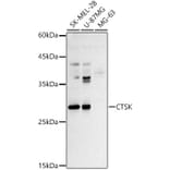 Western Blot - Anti-Cathepsin K Antibody (A13651) - Antibodies.com