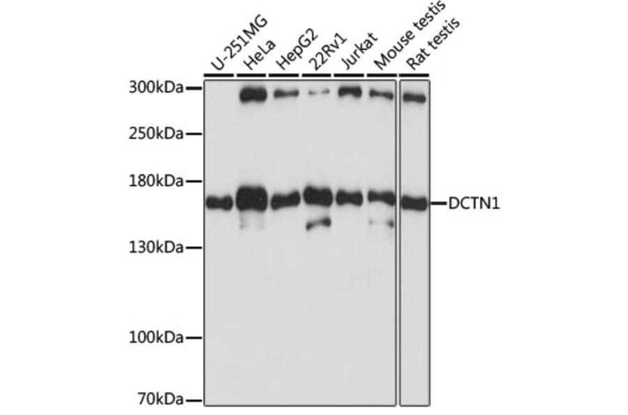 Western Blot - Anti-DCTN1/p150-glued Antibody (A13652) - Antibodies.com