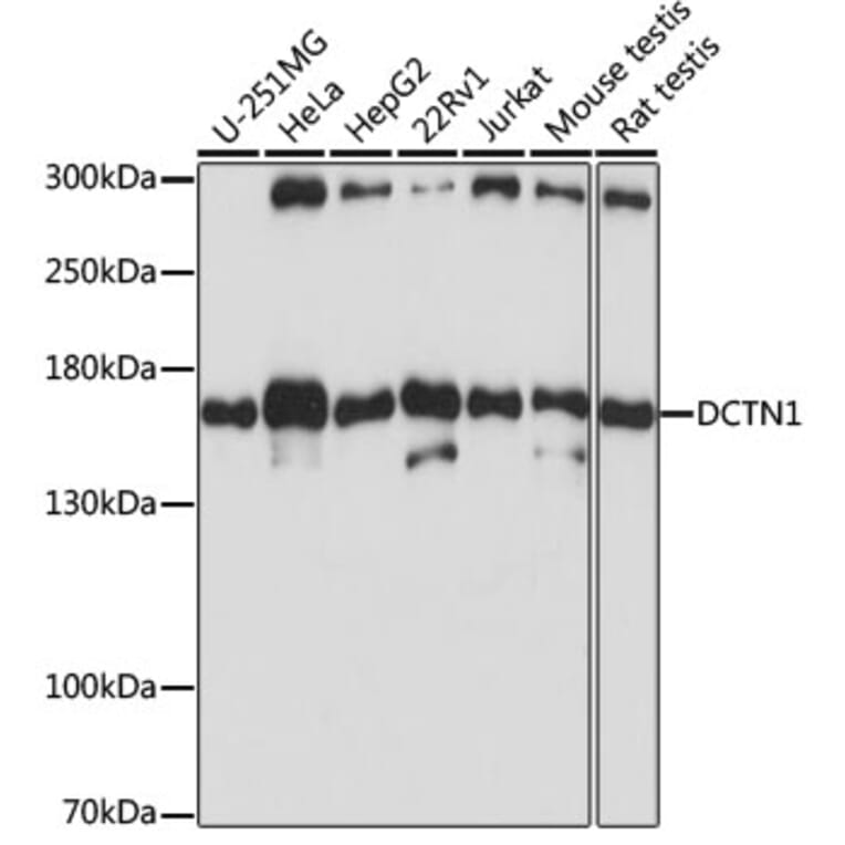 Western Blot - Anti-DCTN1/p150-glued Antibody (A13652) - Antibodies.com