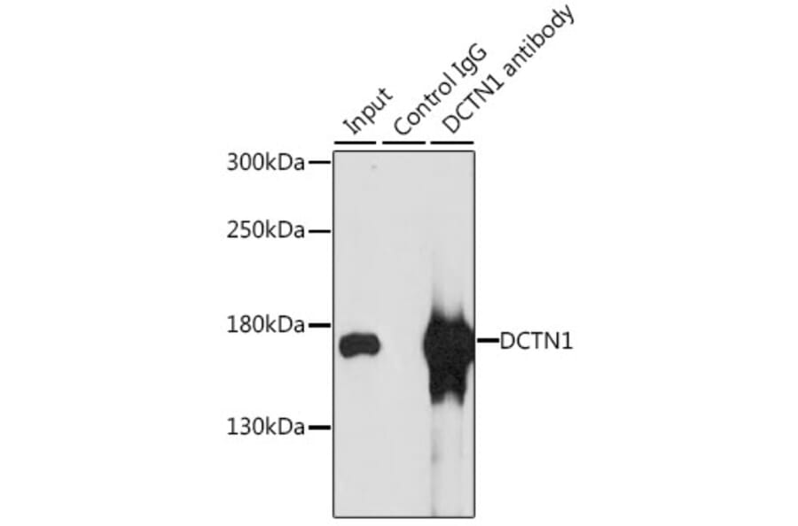 Western Blot - Anti-DCTN1/p150-glued Antibody (A13652) - Antibodies.com
