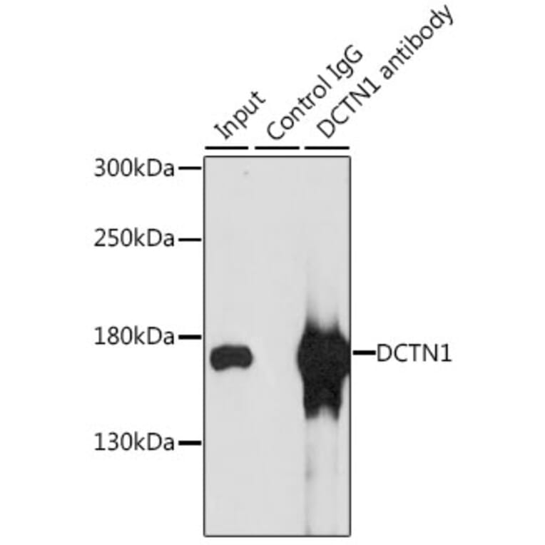 Western Blot - Anti-DCTN1/p150-glued Antibody (A13652) - Antibodies.com