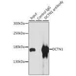 Western Blot - Anti-DCTN1/p150-glued Antibody (A13652) - Antibodies.com