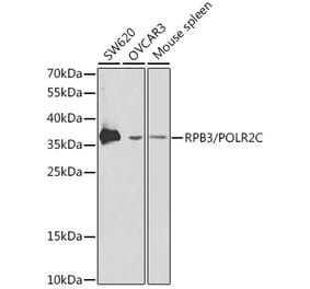 Western Blot - Anti-RPB3 Antibody (A13654) - Antibodies.com