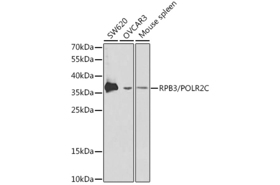 Western Blot - Anti-RPB3 Antibody (A13654) - Antibodies.com