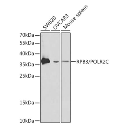 Western Blot - Anti-RPB3 Antibody (A13654) - Antibodies.com