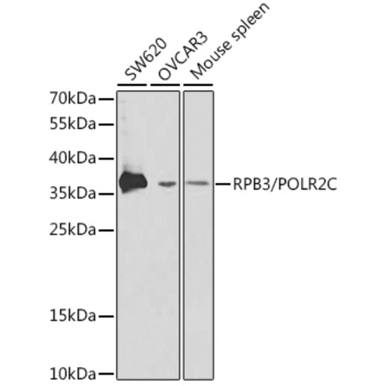 Western Blot - Anti-RPB3 Antibody (A13654) - Antibodies.com