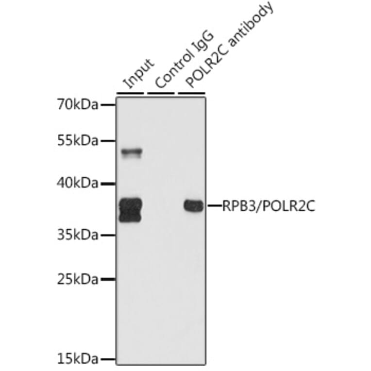 Western Blot - Anti-RPB3 Antibody (A13654) - Antibodies.com