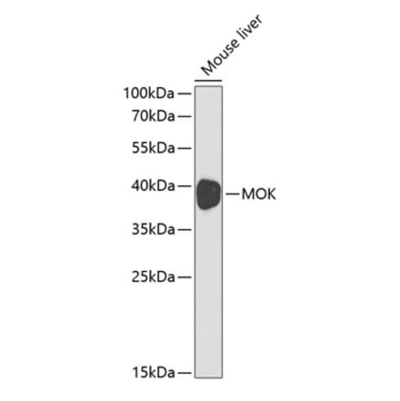 Western Blot - Anti-MOK protein kinase Antibody (A13655) - Antibodies.com