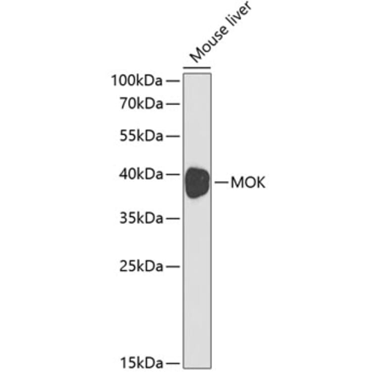 Western Blot - Anti-MOK protein kinase Antibody (A13655) - Antibodies.com