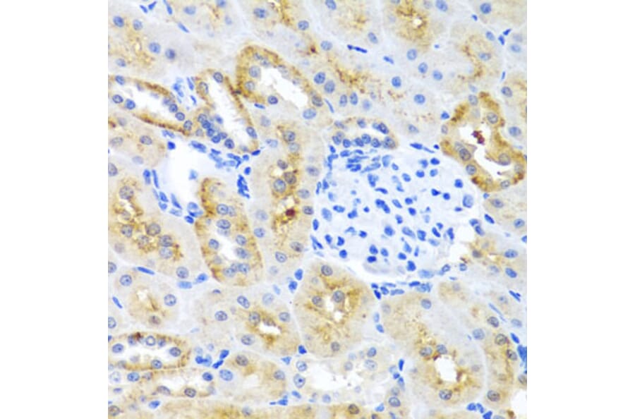 Immunohistochemistry - Anti-MOK protein kinase Antibody (A13655) - Antibodies.com