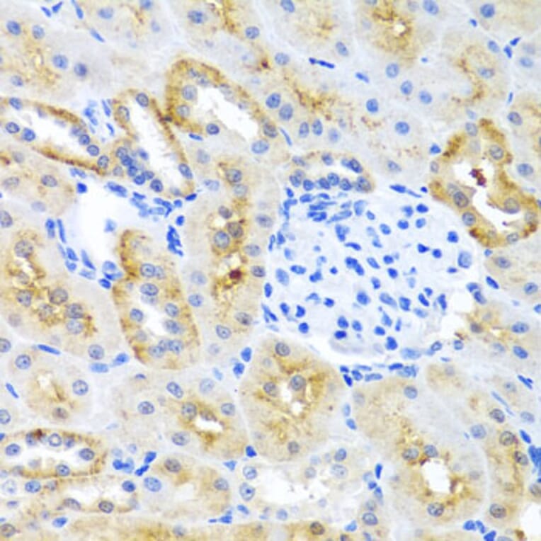 Immunohistochemistry - Anti-MOK protein kinase Antibody (A13655) - Antibodies.com