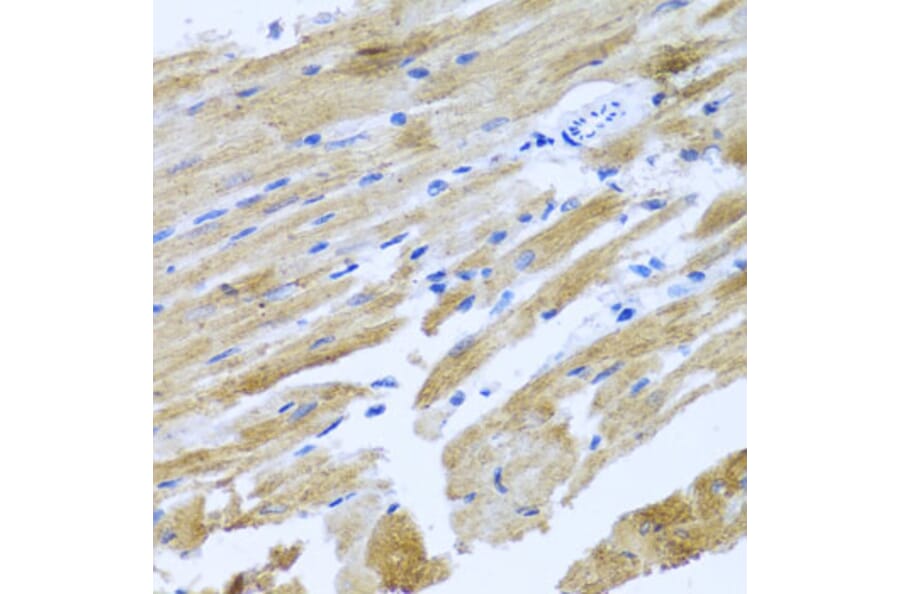 Immunohistochemistry - Anti-MOK protein kinase Antibody (A13655) - Antibodies.com