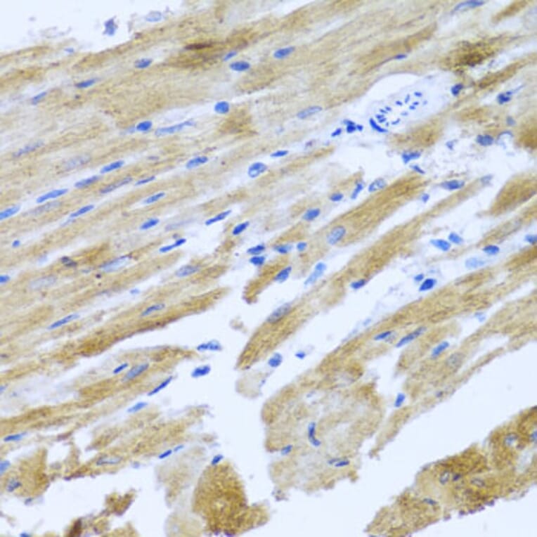 Immunohistochemistry - Anti-MOK protein kinase Antibody (A13655) - Antibodies.com