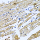 Immunohistochemistry - Anti-MOK protein kinase Antibody (A13655) - Antibodies.com