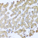 Immunohistochemistry - Anti-MOK protein kinase Antibody (A13655) - Antibodies.com