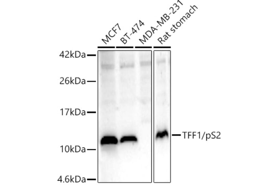 Western Blot - Anti-Estrogen Inducible Protein pS2 Antibody (A13656) - Antibodies.com