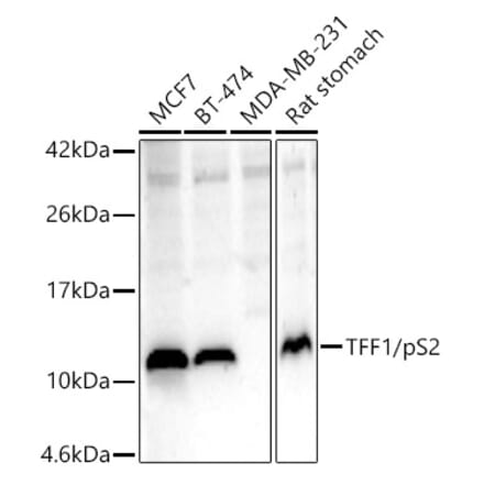 Western Blot - Anti-Estrogen Inducible Protein pS2 Antibody (A13656) - Antibodies.com