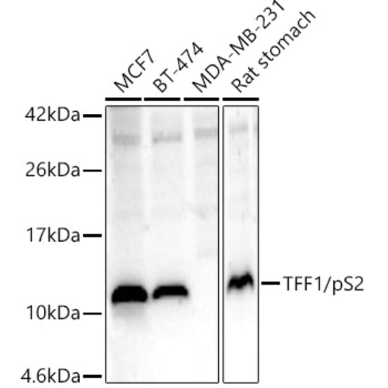 Western Blot - Anti-Estrogen Inducible Protein pS2 Antibody (A13656) - Antibodies.com