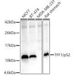 Western Blot - Anti-Estrogen Inducible Protein pS2 Antibody (A13656) - Antibodies.com