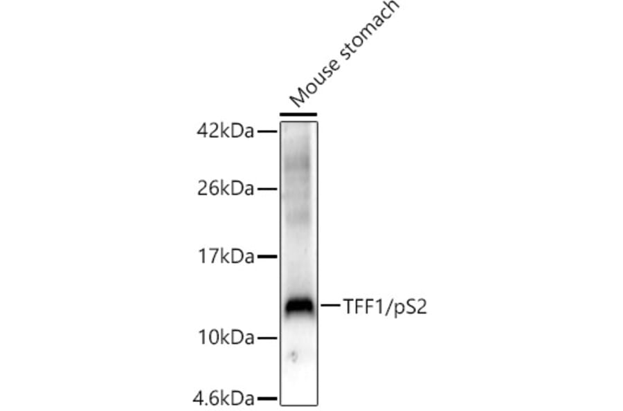 Western Blot - Anti-Estrogen Inducible Protein pS2 Antibody (A13656) - Antibodies.com