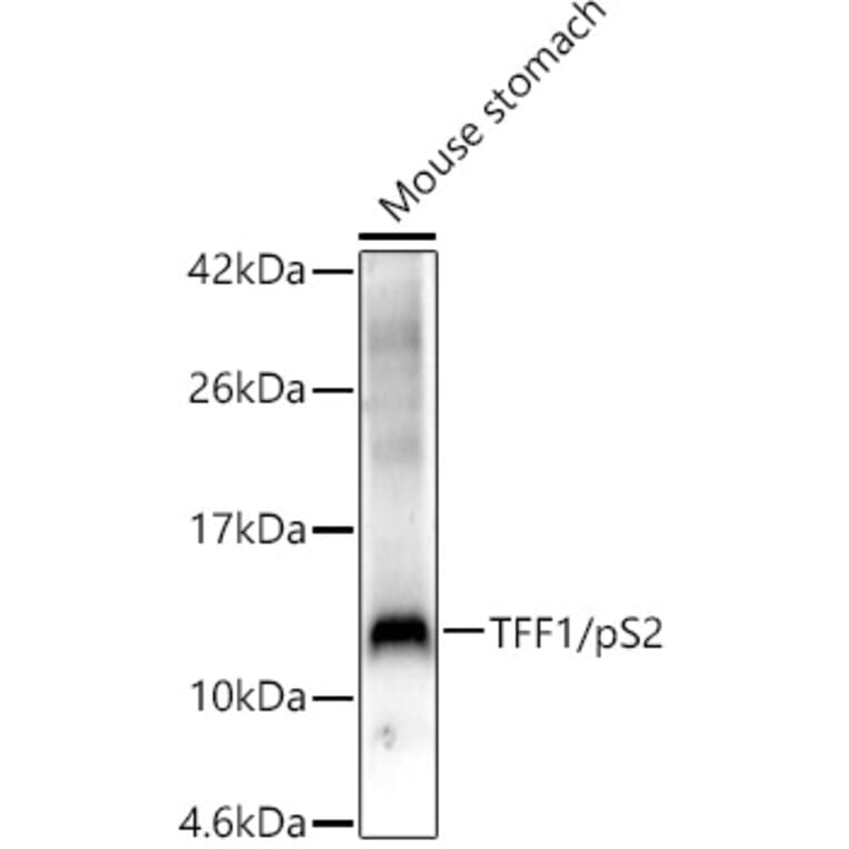 Western Blot - Anti-Estrogen Inducible Protein pS2 Antibody (A13656) - Antibodies.com