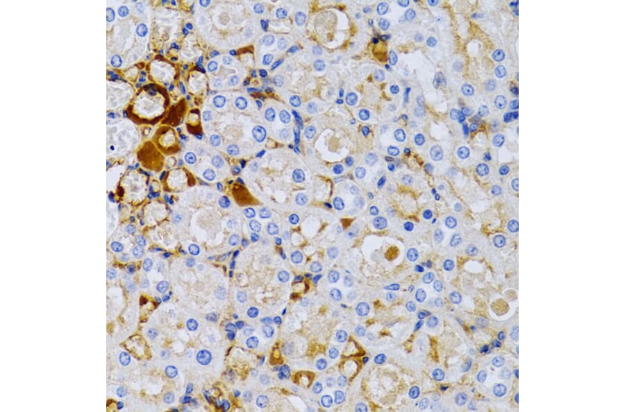 Immunohistochemistry - Anti-Estrogen Inducible Protein pS2 Antibody (A13656) - Antibodies.com