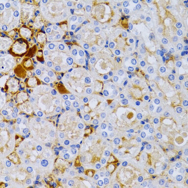Immunohistochemistry - Anti-Estrogen Inducible Protein pS2 Antibody (A13656) - Antibodies.com