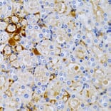 Immunohistochemistry - Anti-Estrogen Inducible Protein pS2 Antibody (A13656) - Antibodies.com