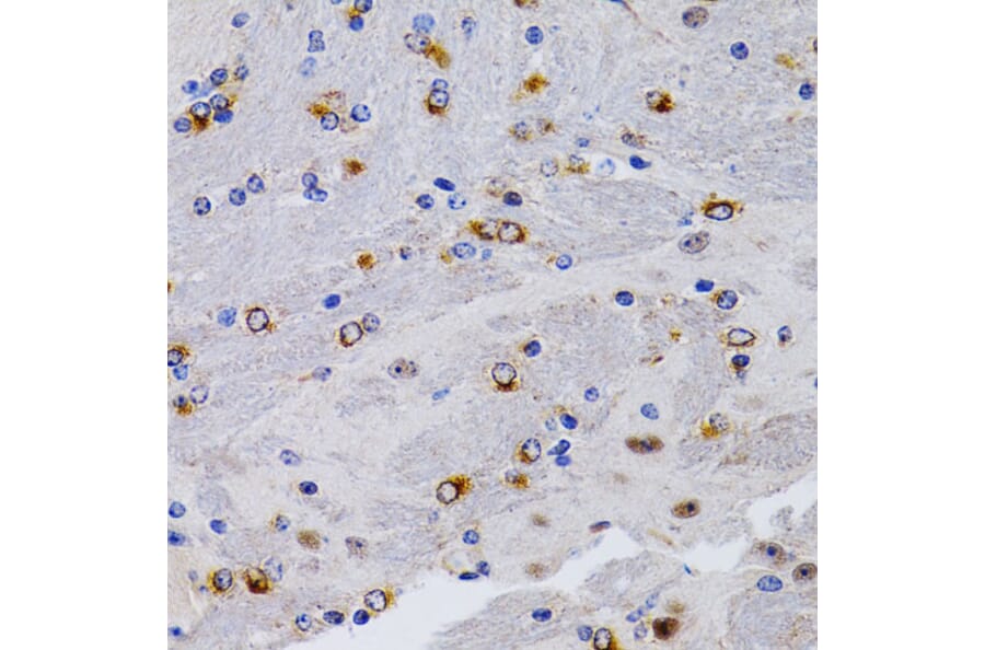 Immunohistochemistry - Anti-Estrogen Inducible Protein pS2 Antibody (A13656) - Antibodies.com