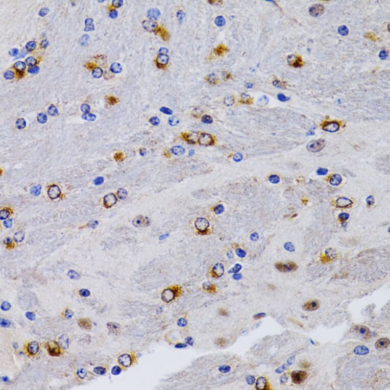 Immunohistochemistry - Anti-Estrogen Inducible Protein pS2 Antibody (A13656) - Antibodies.com