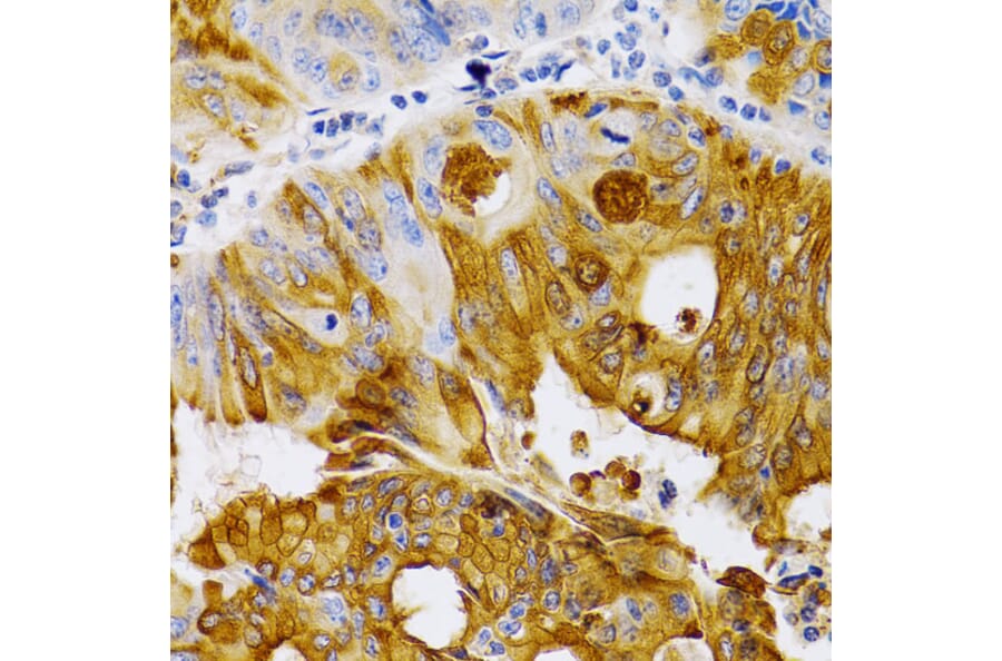 Immunohistochemistry - Anti-Estrogen Inducible Protein pS2 Antibody (A13656) - Antibodies.com