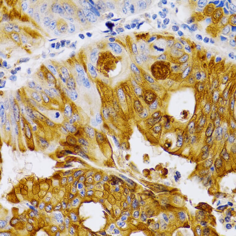 Immunohistochemistry - Anti-Estrogen Inducible Protein pS2 Antibody (A13656) - Antibodies.com