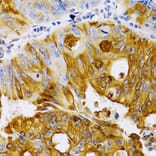 Immunohistochemistry - Anti-Estrogen Inducible Protein pS2 Antibody (A13656) - Antibodies.com