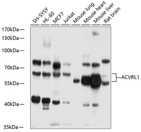 Western Blot - Anti-ALK-1 Antibody (A13657) - Antibodies.com