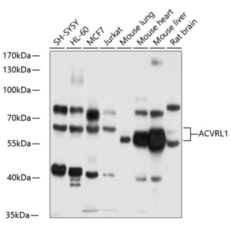 Western Blot - Anti-ALK-1 Antibody (A13657) - Antibodies.com