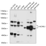 Western Blot - Anti-ALK-1 Antibody (A13657) - Antibodies.com