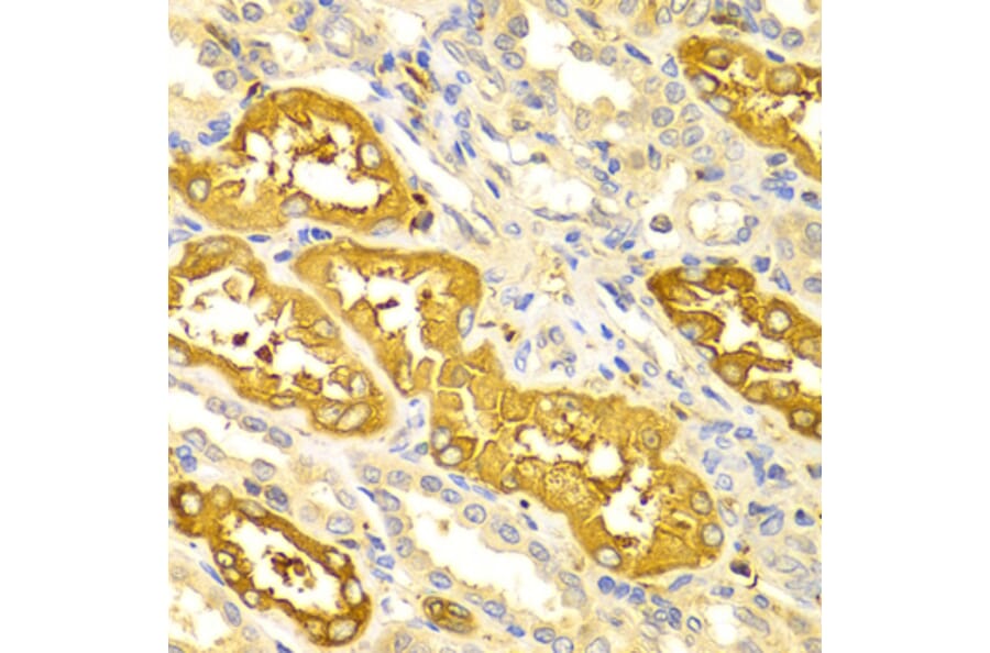 Immunohistochemistry - Anti-BIN1 Antibody (A13658) - Antibodies.com