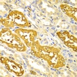 Immunohistochemistry - Anti-BIN1 Antibody (A13658) - Antibodies.com
