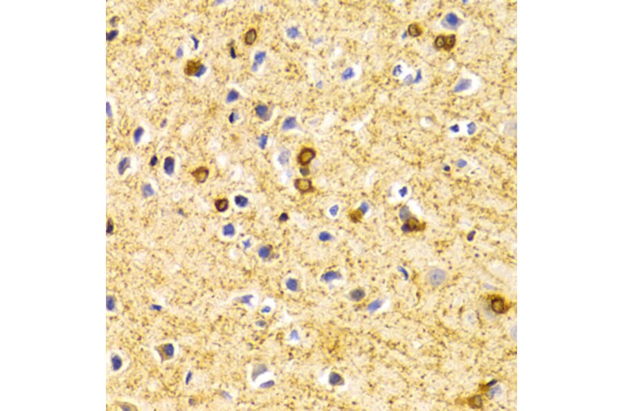Immunohistochemistry - Anti-BIN1 Antibody (A13658) - Antibodies.com