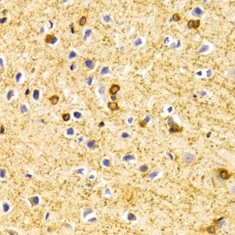 Immunohistochemistry - Anti-BIN1 Antibody (A13658) - Antibodies.com