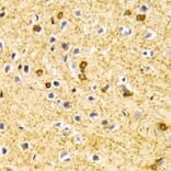 Immunohistochemistry - Anti-BIN1 Antibody (A13658) - Antibodies.com