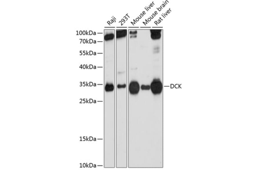 Western Blot - Anti-DCK Antibody (A13659) - Antibodies.com