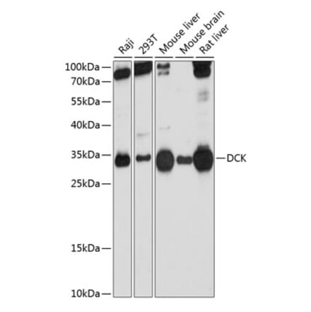 Western Blot - Anti-DCK Antibody (A13659) - Antibodies.com