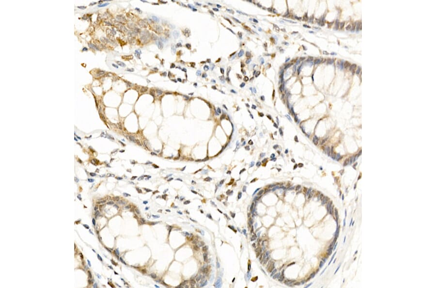Immunohistochemistry - Anti-RGS2 Antibody (A13660) - Antibodies.com
