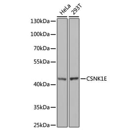 Western Blot - Anti-CK1 epsilon Antibody (A13661) - Antibodies.com