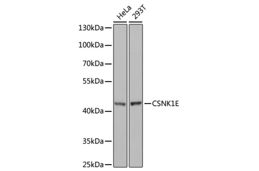 Western Blot - Anti-CK1 epsilon Antibody (A13661) - Antibodies.com