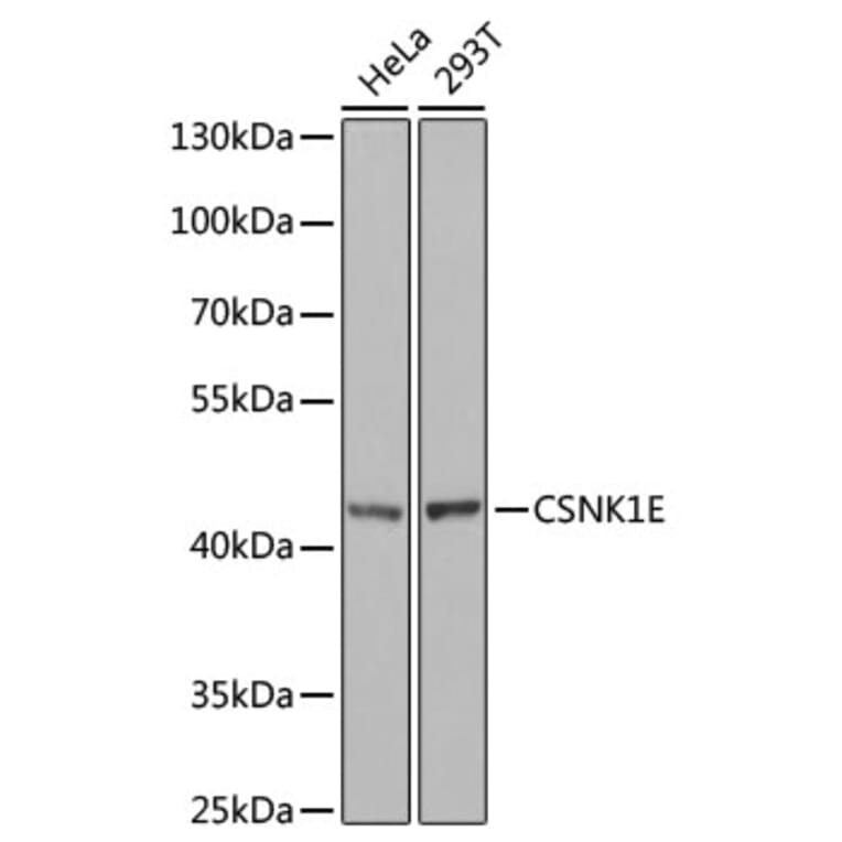 Western Blot - Anti-CK1 epsilon Antibody (A13661) - Antibodies.com