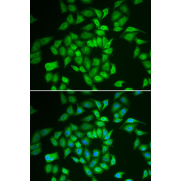 Immunofluorescence - Anti-CK1 epsilon Antibody (A13661) - Antibodies.com