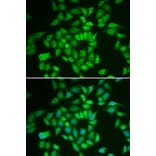 Immunofluorescence - Anti-CK1 epsilon Antibody (A13661) - Antibodies.com